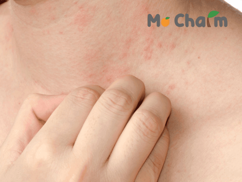 Đeo dây chuyền bị kích ứng da với những làn da mẫn cảm 