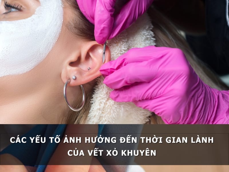Các yếu tố ảnh hưởng đến thời gian lành của vết xỏ khuyên